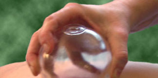 Cupping terapija
